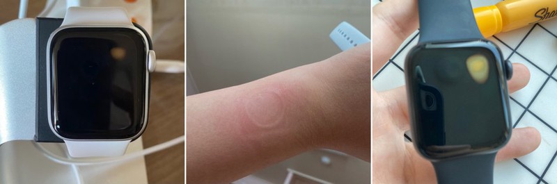 Apple Watch Reparatur